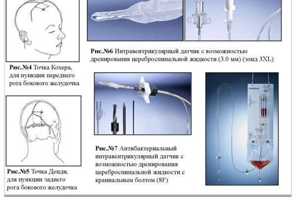 Ссылки на кракен маркетплейс тг